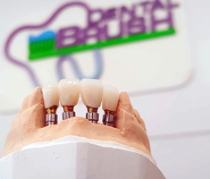 Slider image (8) Dental Brush Mexicali
